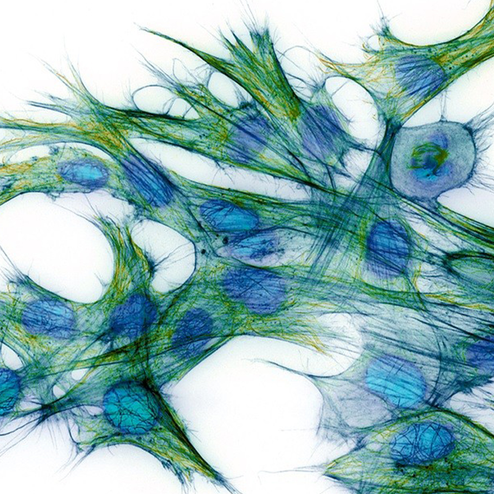 Indalo Therapeutics
